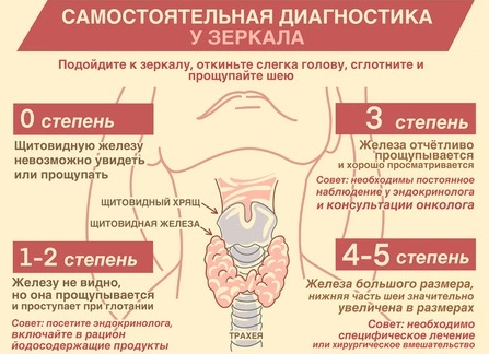 Лечение узлов в щитовидной железе