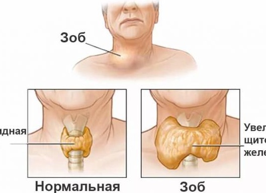 Щитовидная железа: функции, причины нарушений