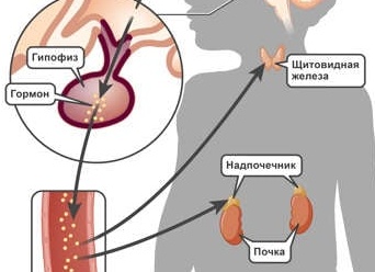Когда щитовидная железа вырабатывает больше гормонов, чем необходимо вашему организму