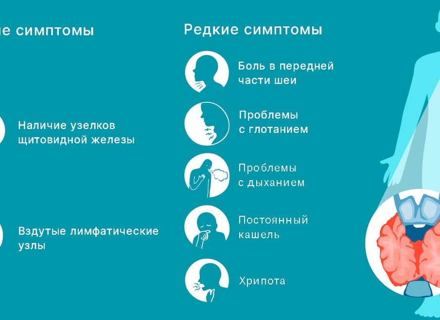 Рак щитовидной железы - виды, симптомы и УЗИ признаки