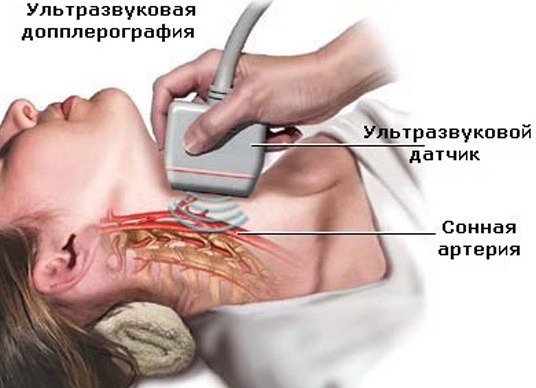 УЗИ щитовидной железы